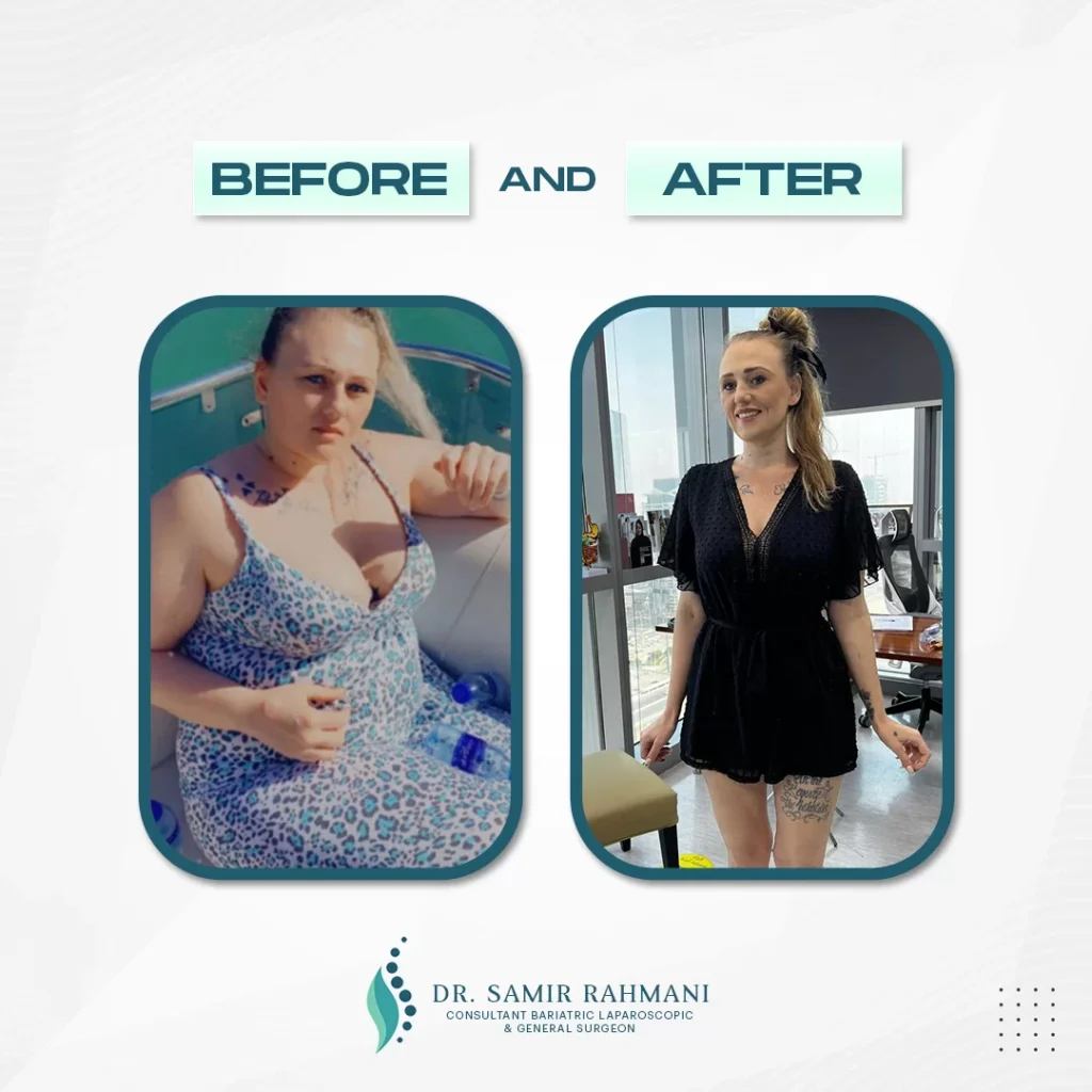 3Dr.-Samir_Post-Before-and-After-2
