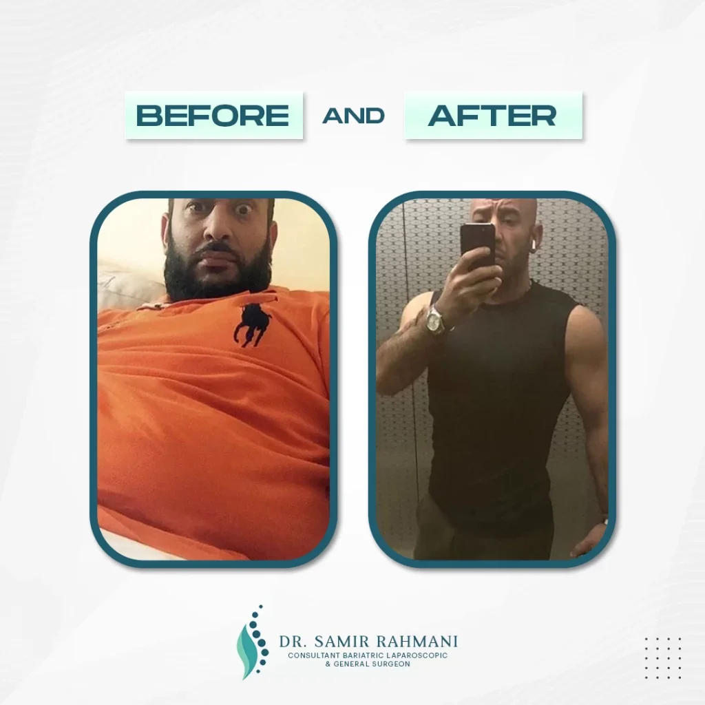 4Dr.-Samir_Post-Before-and-After-2