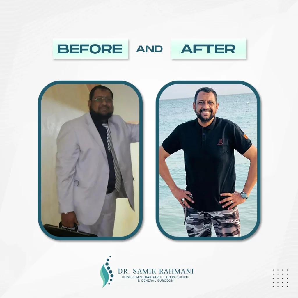 5Dr.-Samir_Post-Before-and-After-2