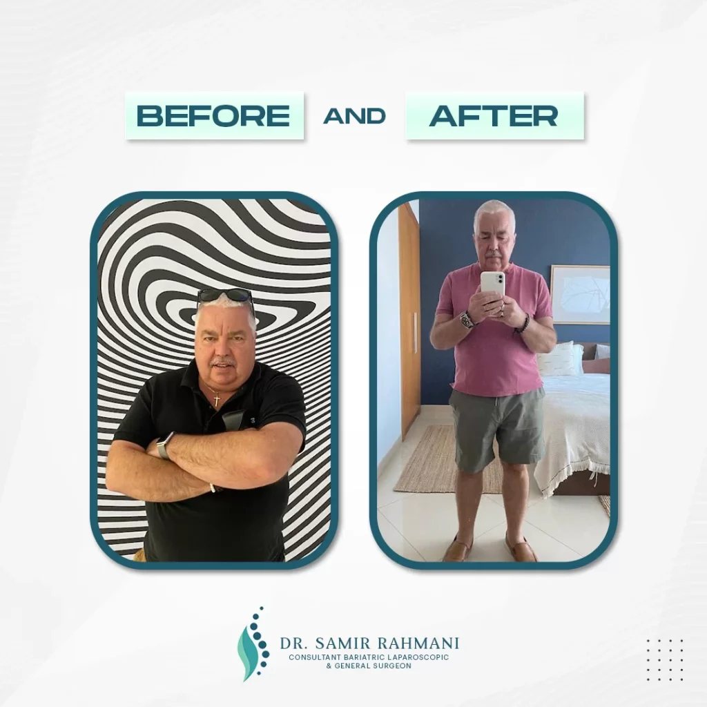6Dr.-Samir_Post-Before-and-After-2