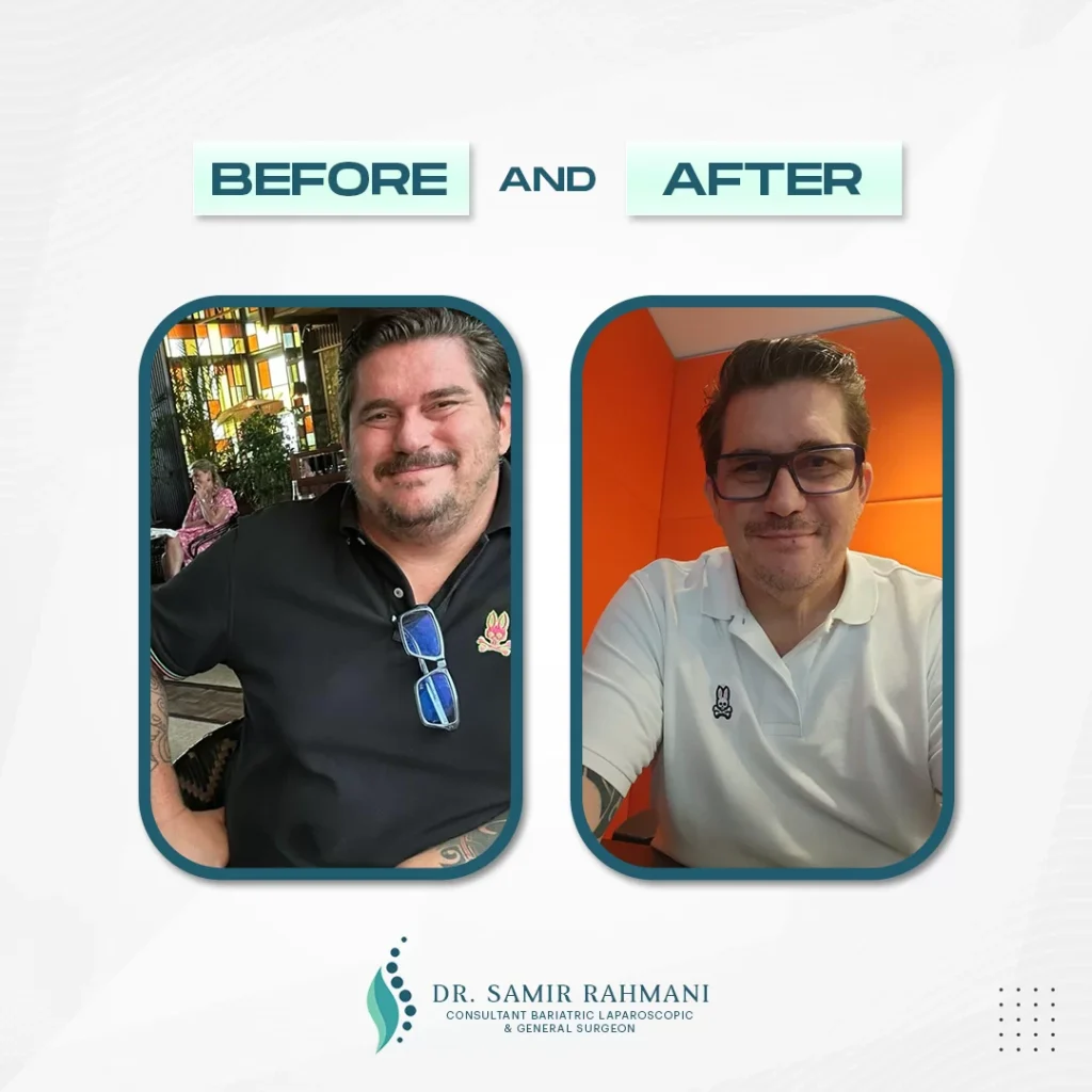 7Dr.-Samir_Post-Before-and-After-2