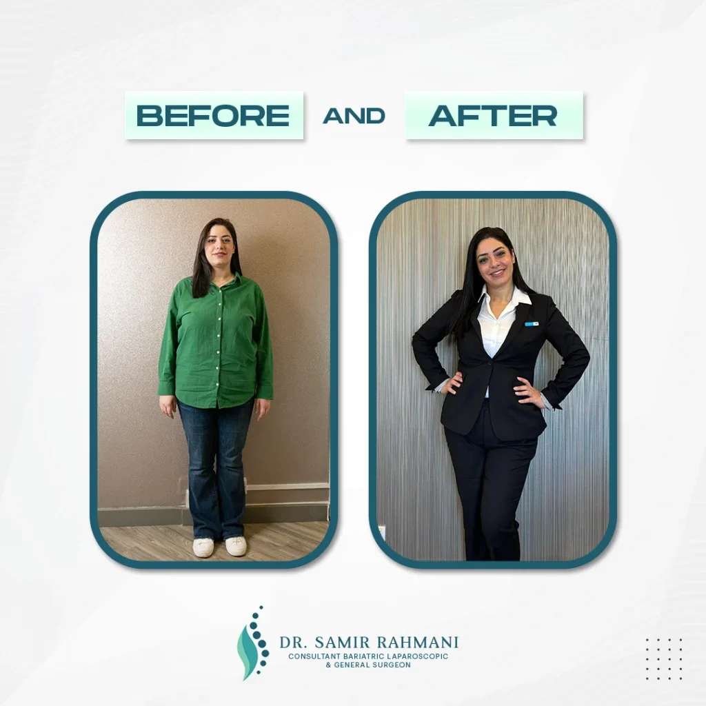 Dr.-Samir_Post-Before-and-After