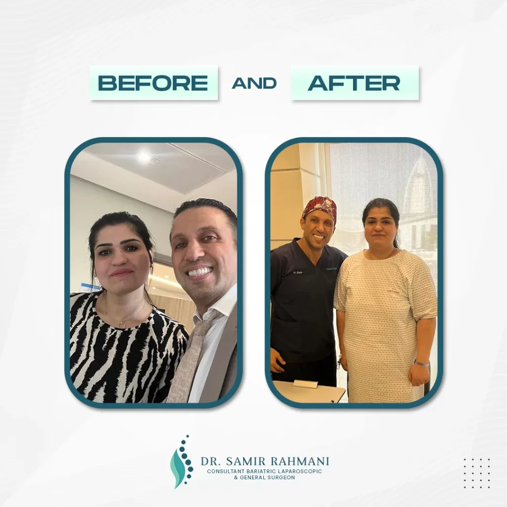 Dr.-Samir_Post-Before-and-After-2