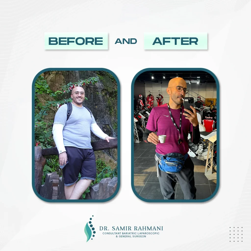 Dr.-Samir_Post-Before-and-After1
