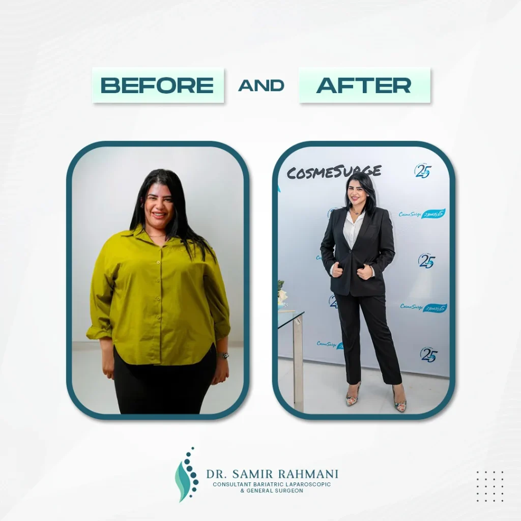 Dr.-Samir_Post-Before-and-After3