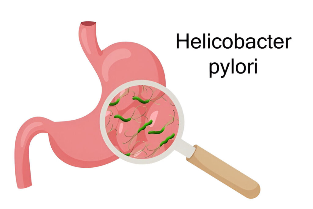 best treatment for gastritis