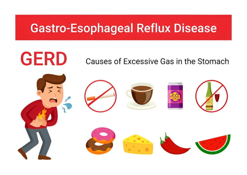 foods that help acid reflux