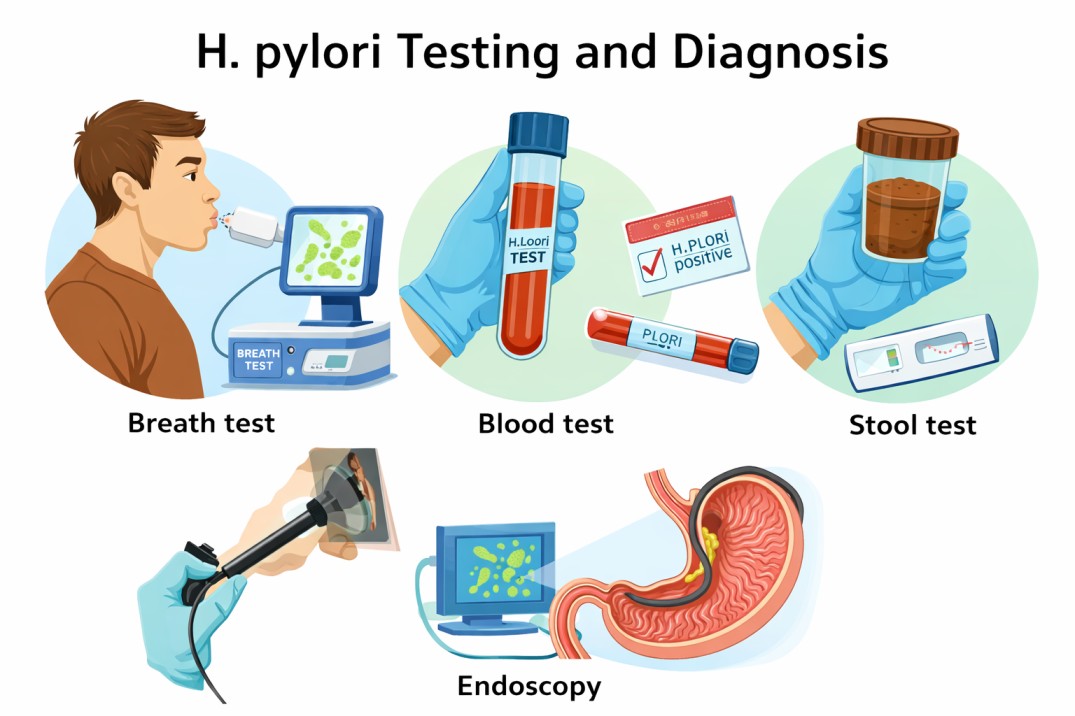 h pylori test