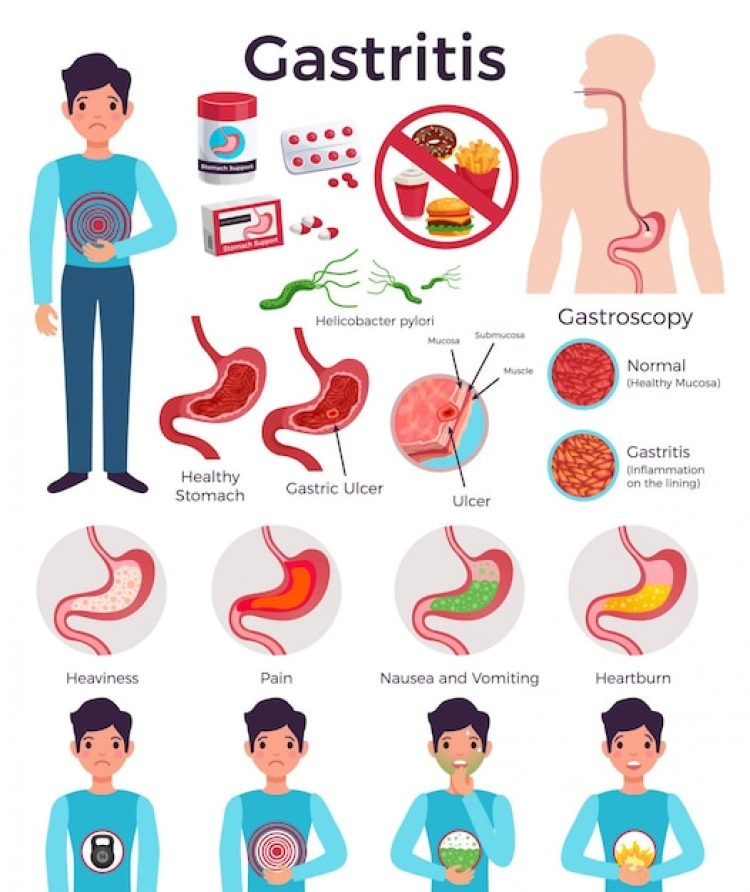 symptoms of gastritis